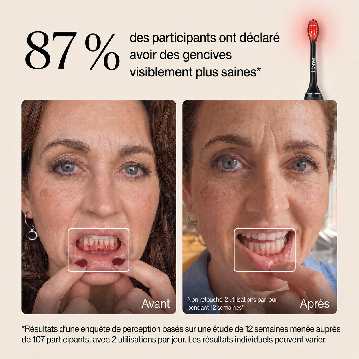 Brosse à dents Llorrea à lumière rouge + bleue