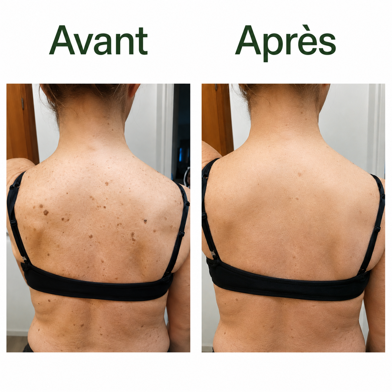 Llorrea — Stick Corps Lissant à l'Acide Glycolique 7%